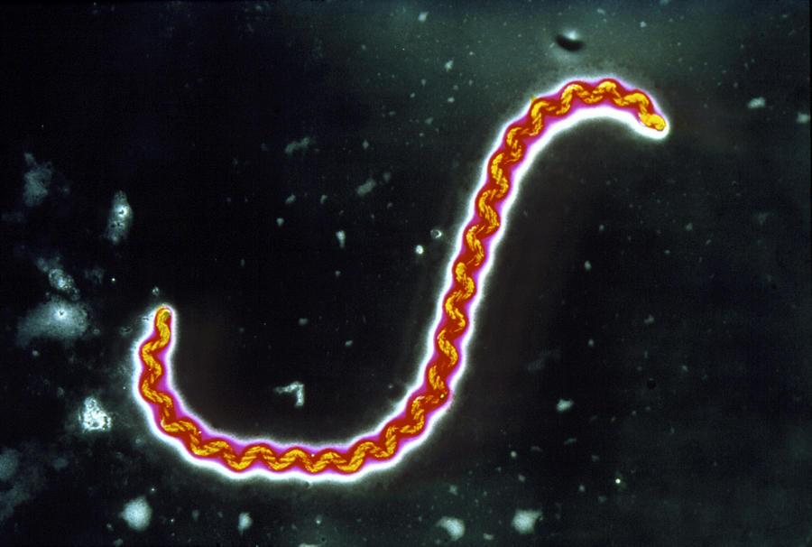 xoan-khuan-vang-da-leptospirosis